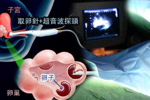 郑州代孕辅助生殖中心成功率|在公立医院做供卵试管包男孩需要等多久？长沙