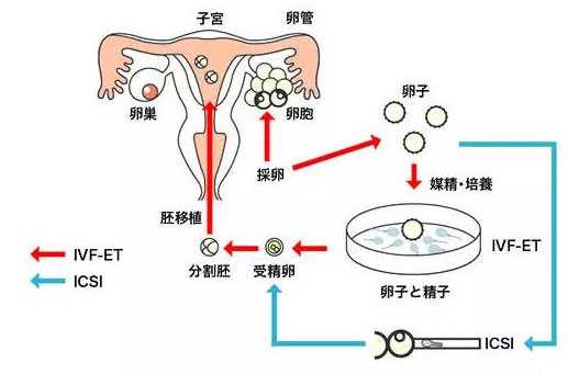 试管婴儿的步骤过程详细图解，揭秘试管宝宝诞生全过程！